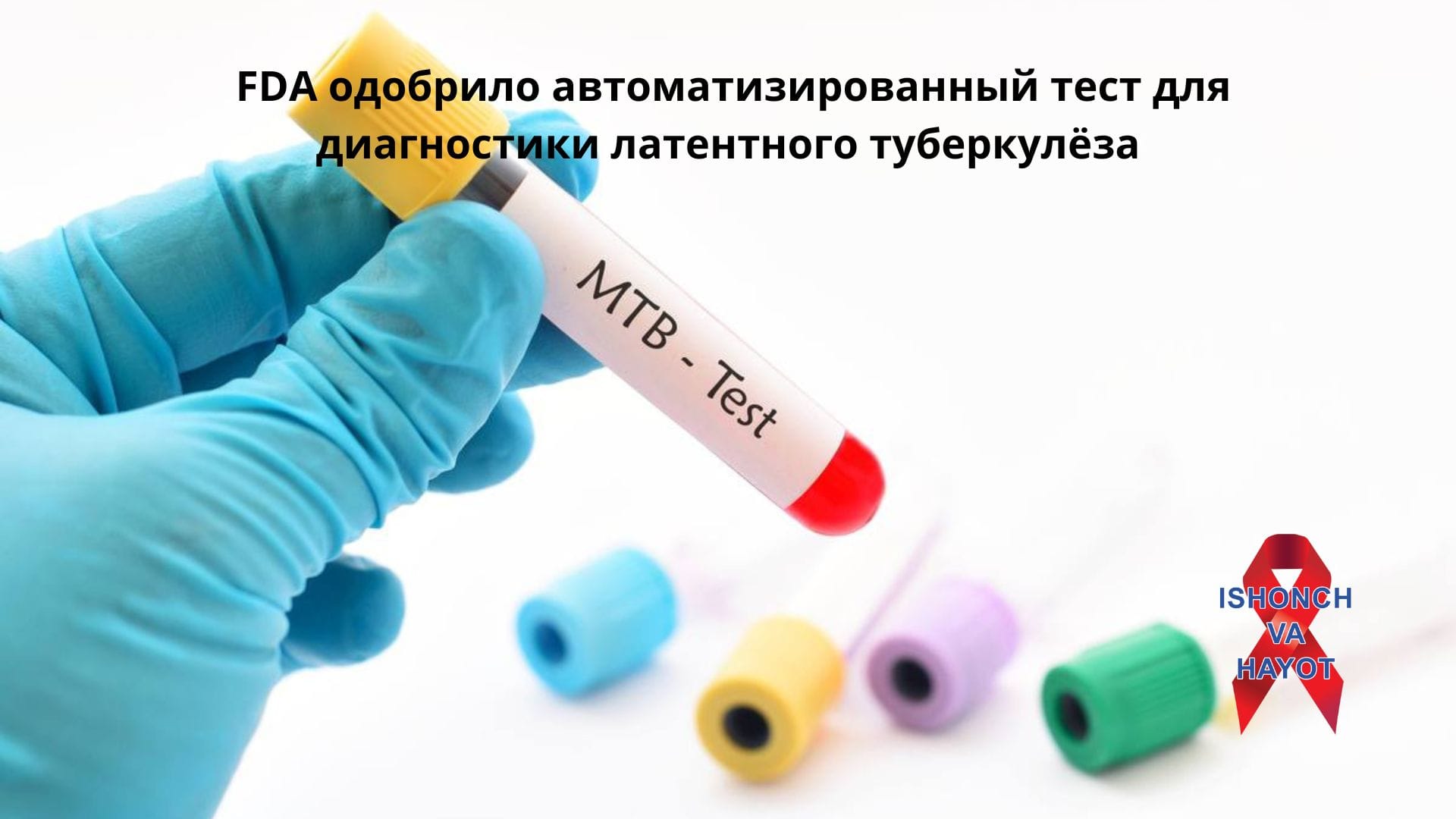 FDA одобрило автоматизированный тест для диагностики латентного туберкулёза