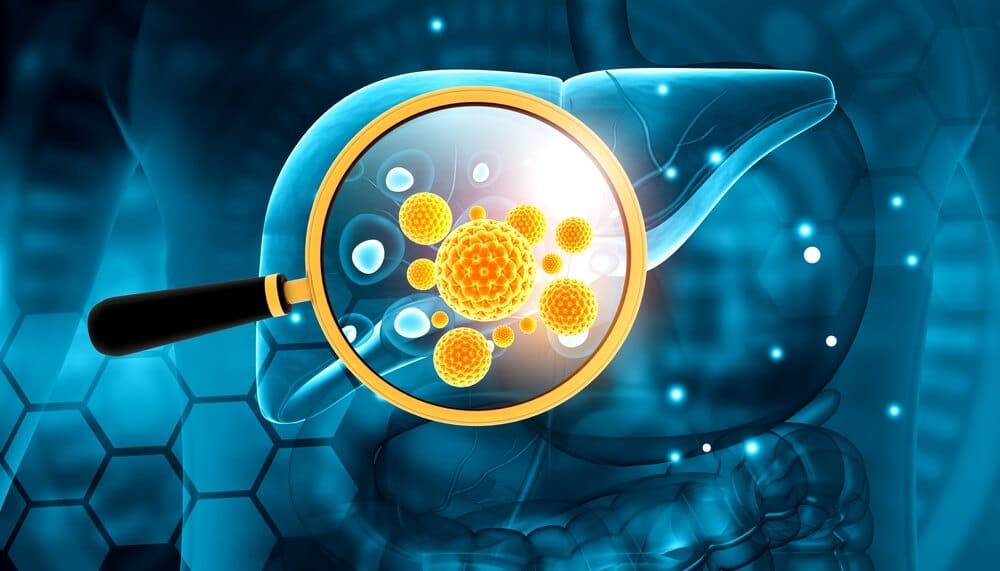 Реактивация гепатита В при смене АРВТ у пациентов с ВИЧ